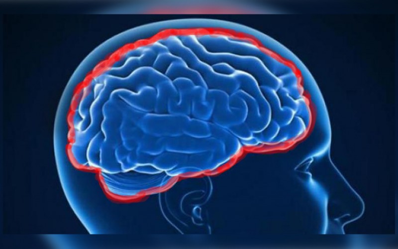 Resultado de imagen para meningitis