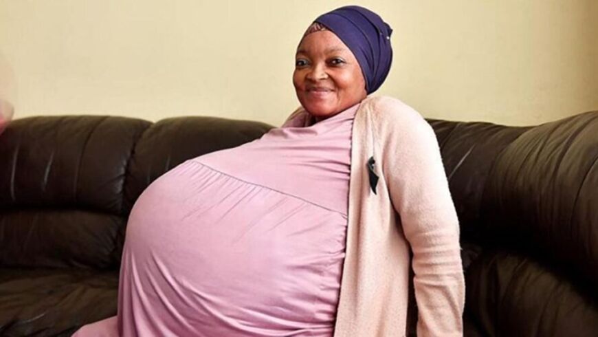 Impresionante parto de una mujer que esperaba octillizos: nacieron 10 bebés